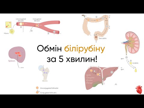 Метаболізм білірубіну за 5 ХВИЛИН!