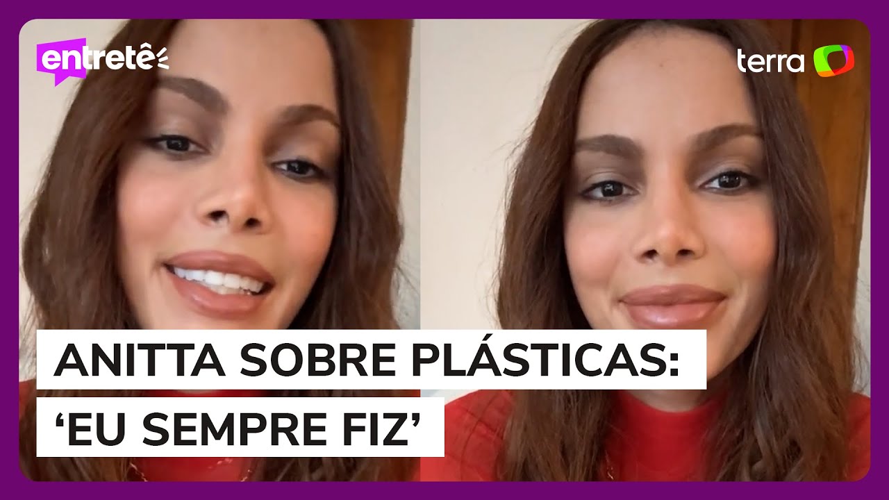 Anitta fala pela primeira vez sobre a repercussão das novas plásticas