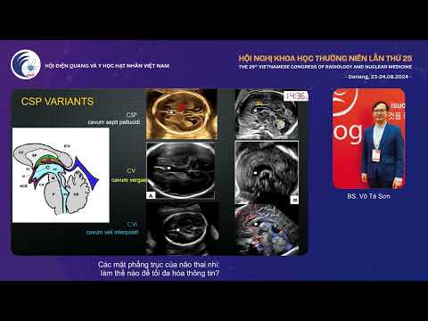 3. Các mặt phẳng trục của não thai nhi: làm thế nào để tối đa hóa thông tin? (BS. Võ Tá Sơn)