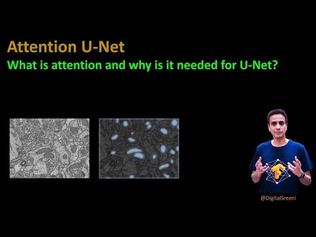 Attention UNET in PyTorch