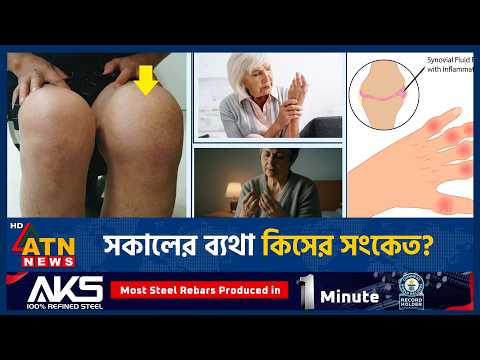 | Rheumatoid <strong>Arthritis</strong> Symptoms | ATN News