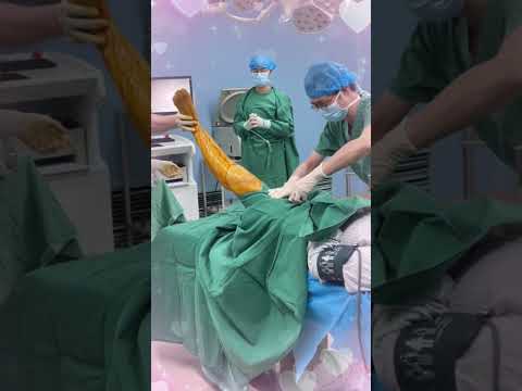 做手术的过程中,医生如何给病人盖上无菌布? #doctor #hospital #颈肩腰酸痛