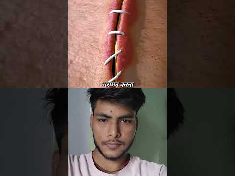 How Stitches Works!!! 😧 |टाँके कैसे काम करता है?| Gyan and Vigyan #shorts #viral #reels #video #duet