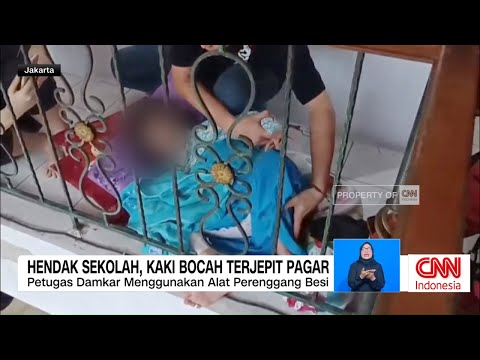 Hendak Sekolah, Kaki Bocah Terjepit Pagar
