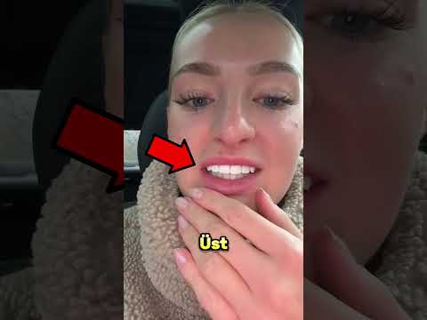 Gülüşünü Parlatmak İsterken Büyük Bir Hata Yaptı.. 😬💅