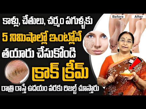 Ramaa Raavi -  Get Rid Of Dry Cracked Feet Fast making at Home in 5 Minutes telugu || SumanTV