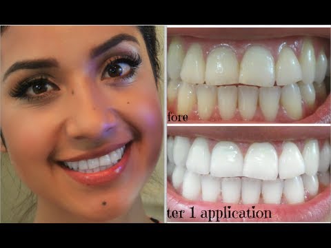 My Oral Hygiene + How I Keep a White Smile | Dulce Candy - UCo5zIpjl2OQkYatd8R0bDaw