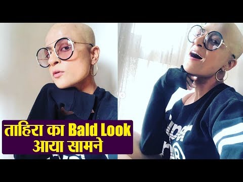 Video - Ayushmann Khurana's wife Tahira Kashyap goes Bald post Cancer Treatment. Tahira is now living the life cancer free. However, the director has decided to ditch her hair extensions and share her bald look on her Instagram handle. Watch the video to know more !