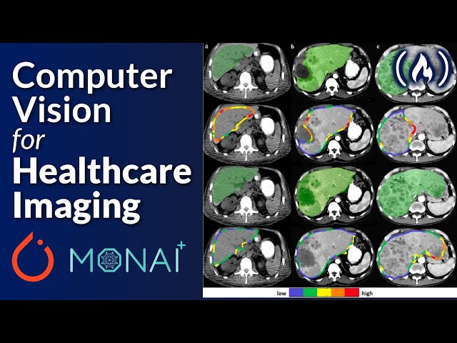 Deep Learning for Medical Imaging – The Complete Course