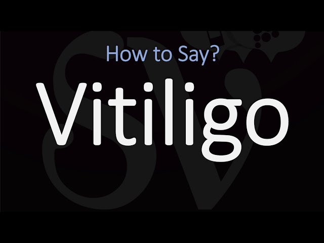 How to Pronounce Vitiligo