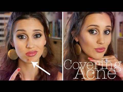 How to Cover a Pimple FLAWLESSLY! - UCwrr3IkHMeDIAj7zjq17qoA