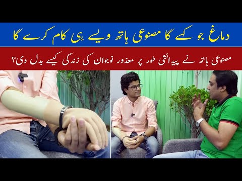 Artificial Hand in Pakistan For Handicapped People