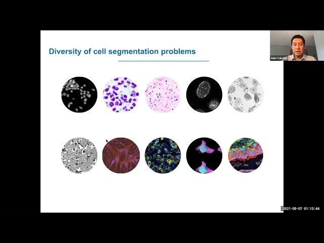 How Deep Learning is Helping Cell Segmentation