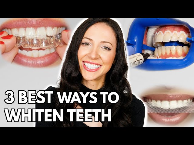 How to Get White Teeth Like the NBA Pros