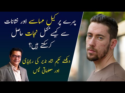 Acne And Pimples Home Remedies | Acne and Pimple Scars Treatment | Tips By Hakeem Shah Nazir