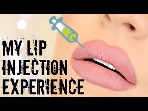 My Lip Injections Experience: Laser Clinics Australia 'Lips to Love' | Stephanie Lange - UCZQ0XPE7wxMafUf8dIHOxgQ