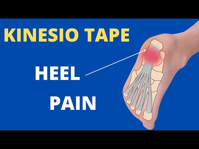 How to Apply Sports Tape for Plantar Fasciitis?