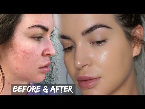 Skin Care Hack for ALL SKIN TYPES! - UCcZ2nCUn7vSlMfY5PoH982Q