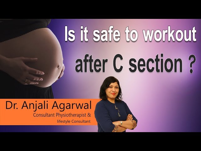 How Long Can You Workout After C Section