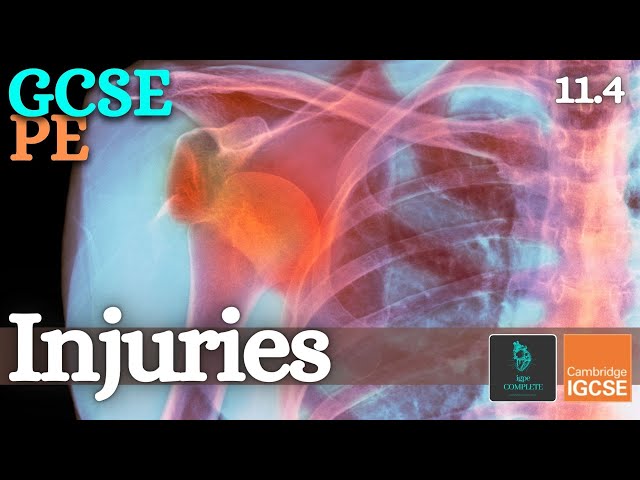 What Causes Sports Injuries? Worksheet Answers