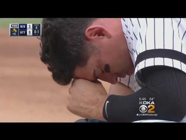 One Baseball Fan’s Unfortunate Experience with a Bat to the Face