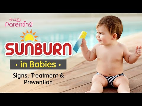 Easy Tips & Precautions for Baby Sunburn