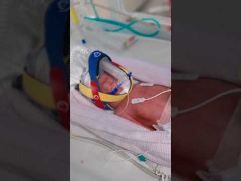 Australian mother welcomes identical quadruplet girls
