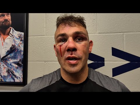 BRUISED & CUT Matty Floyd AFTER JAMES DEGALE BAREKNUCKLE DEFEAT: ‘I THOUGHT I WON!