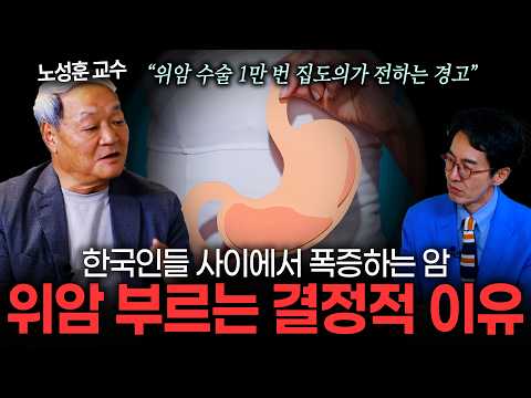 <strong>위암</strong> 수술 1만 1천 번 집도의 노성훈 교수가 말하는 <strong>위암</strong> 예방과 내시경의 중요성 | 노성훈 교수 [EP. 245]