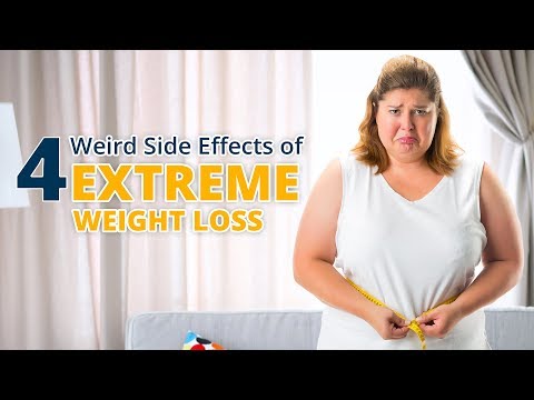 4 Weird Side Effects of Extreme Weight Loss