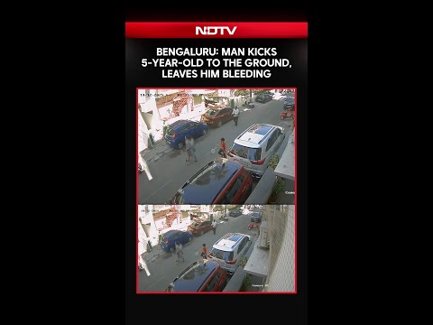 Bengaluru: Man Kicks 5-Year-Old Child to the Ground, Leaves Him Bleeding