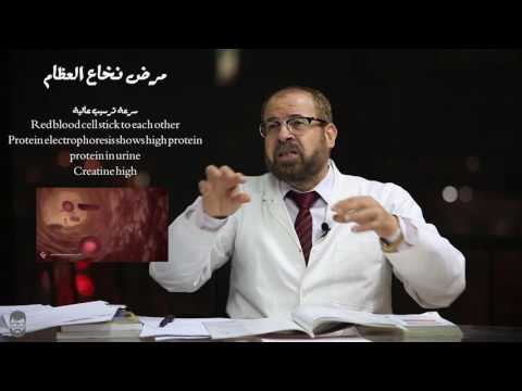 سلسلة تبسيط الطب | مرض نخاع العظام