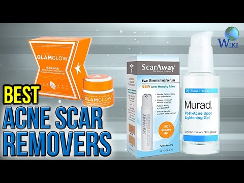 10 Best Acne Scar Removers 2017 - UCXAHpX2xDhmjqtA-ANgsGmw