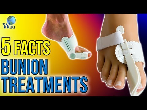 Bunion Treatments: 5 Fast Facts - UCXAHpX2xDhmjqtA-ANgsGmw