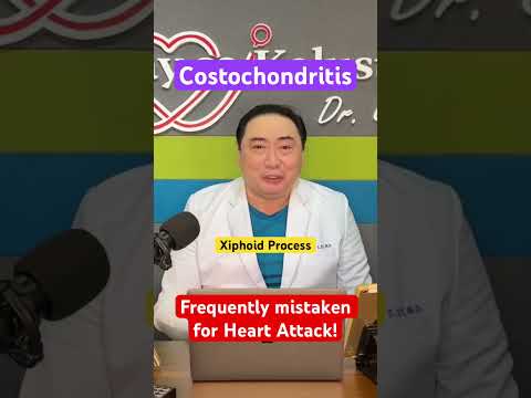 Costochondritis