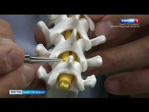 Петербургские ученые рассказали о нейропротезах, которые помогут восстановиться после травмы