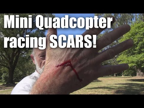 Racing Drone draws blood - UCQ2sg7vS7JkxKwtZuFZzn-g