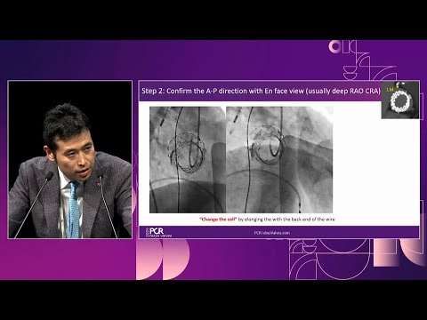Learn the evidence – Lifetime management of aortic stenosis therapy with self-expandable valve
