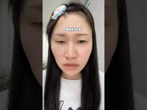 クマ取りをする前にみてほしいです#shorts