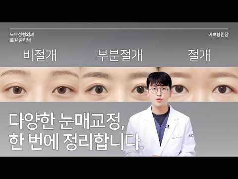 [이보형 원장의 Q&A] 그래서 저는 뭘 해야 하는데요 l 눈매교정 총정리 l 눈매교정 전후 l