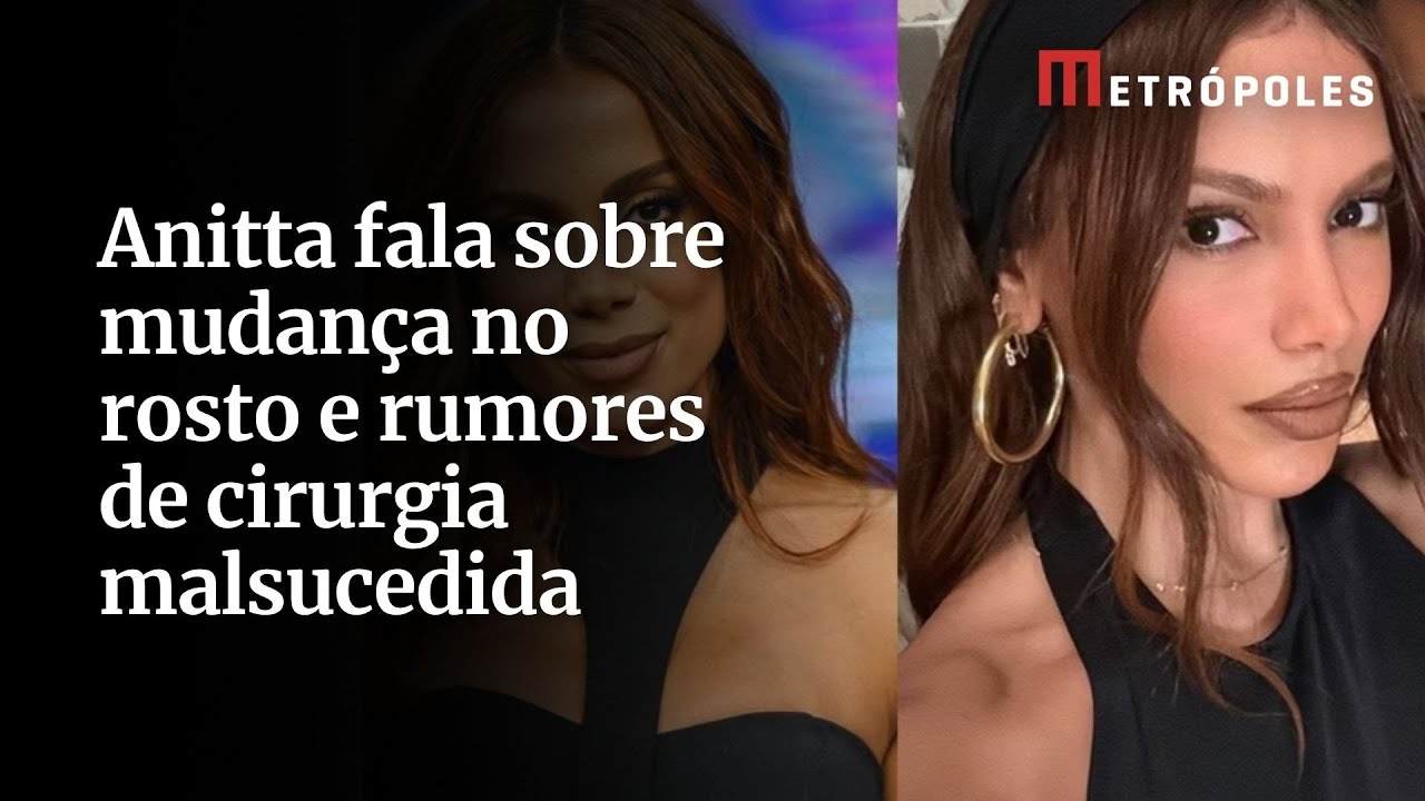 Anitta fala sobre mudança no rosto e rumores de cirurgia malsucedida