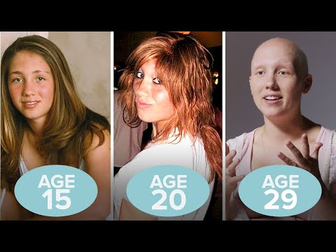 This Woman's Hair Loss in 6 Old Photos | Allure