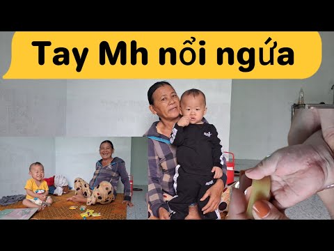 Sáng e mua cháo ghé đúc Mh ăn mới biết tay Mh ngứa quá 