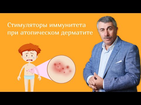 Стимуляторы иммунитета при атопическом дерматите | Доктор Комаровский