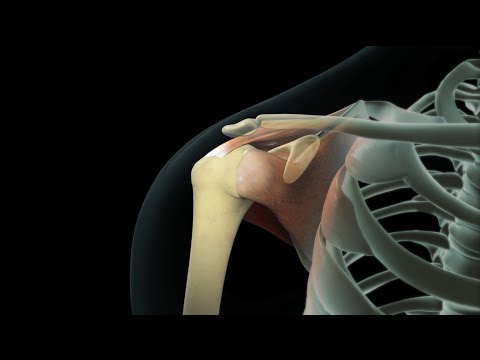 Rotator Cuff Shoulder Surgery - UC85VW73bQLEjs_taFKP7TwQ