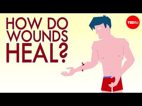 How a wound heals itself - Sarthak Sinha - UCsooa4yRKGN_zEE8iknghZA