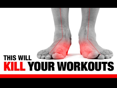 5 Ways Flat Feet “F” Up Your Workouts!! (EXERCISES TO FIX THEM!) - UCe0TLA0EsQbE-MjuHXevj2A