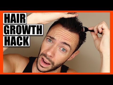 How To Regrow Thinning Hair Fill Bald Spots Hair Growth Hack