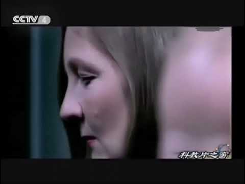 SOD與人體健康。