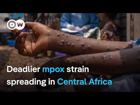 With deadlier mpox strain spreading in Central Africa, what's holding up vaccinations ? | DW News